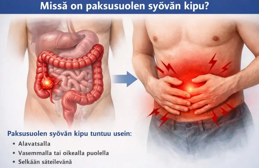 Missä on paksusuolen syövän kipu? Oireet, sijainti ja milloin hakeutua hoitoon